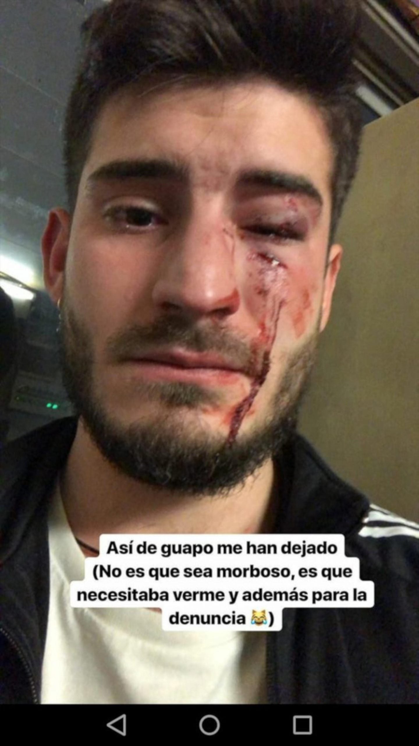 L'estat en què ha quedat la víctima d'una agressió homòfoba al met