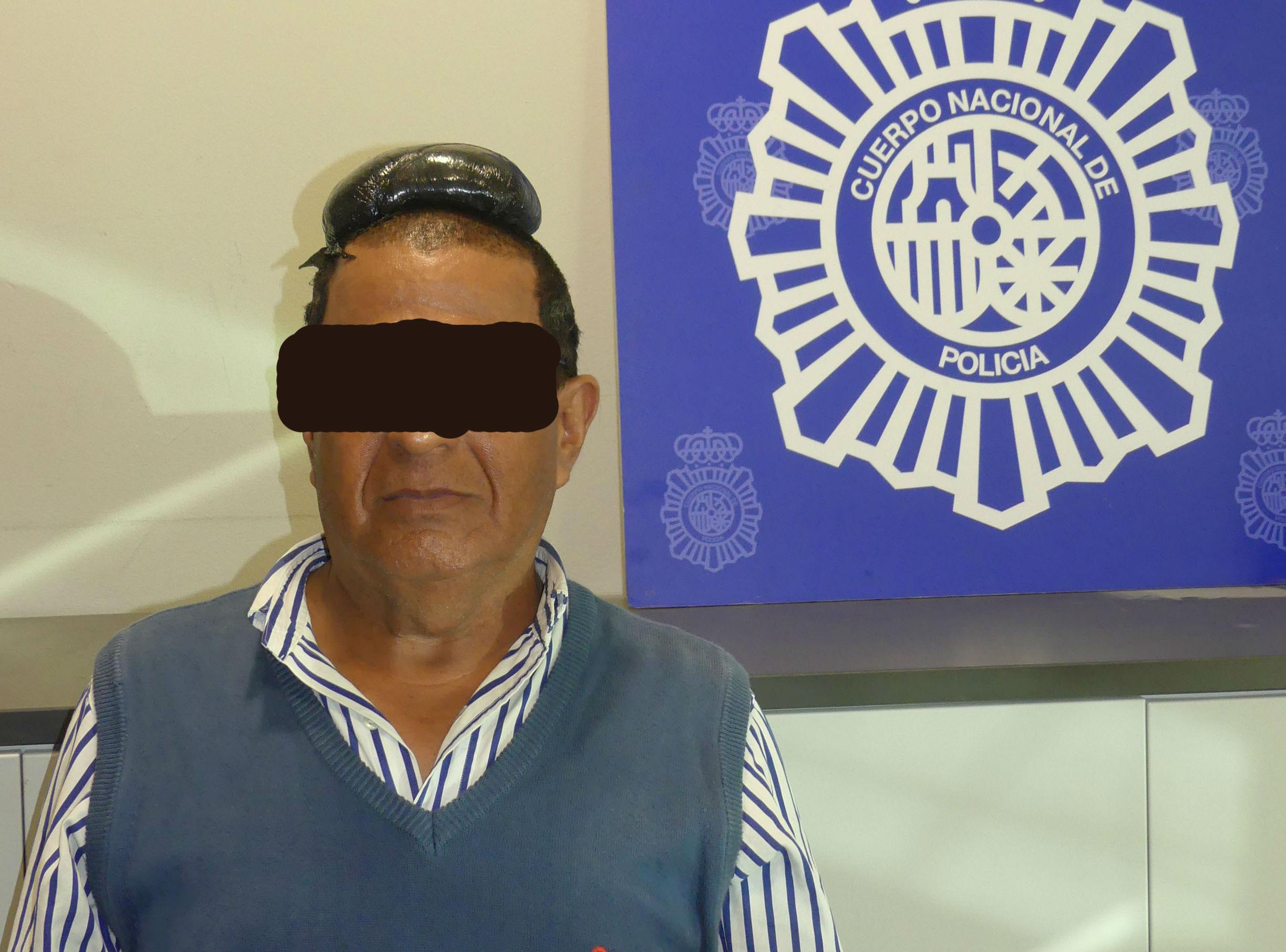 L'home portava un paquet de droga precintat i adherit al cap / CNP