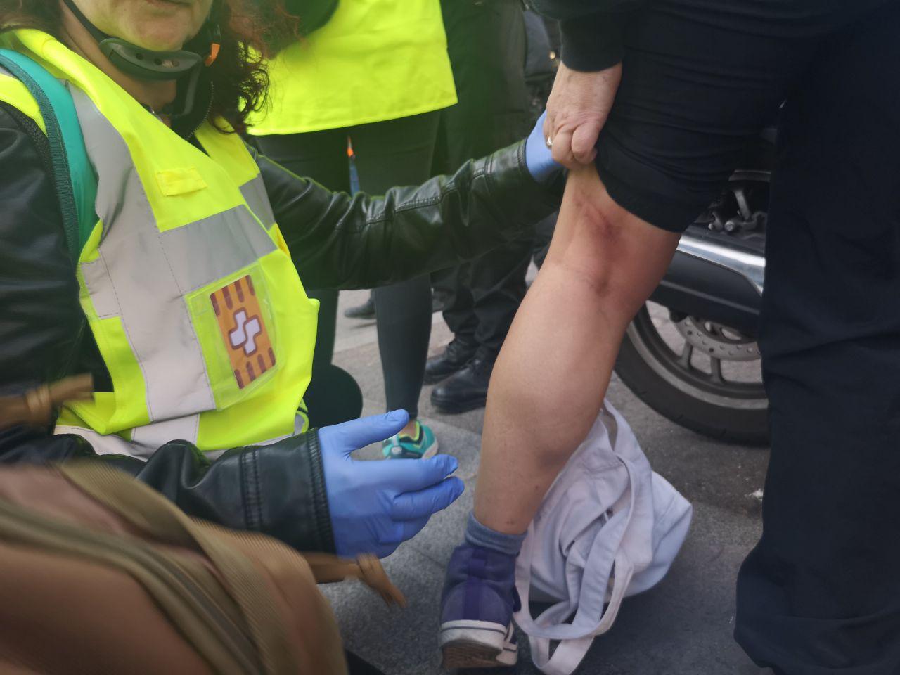 Una dona ha estat atesa per un cop a la cama durant les càrregues policial. / D.C: Una dona ha estat atesa per un cop a la cama durant les càrregues policial. / D.C: