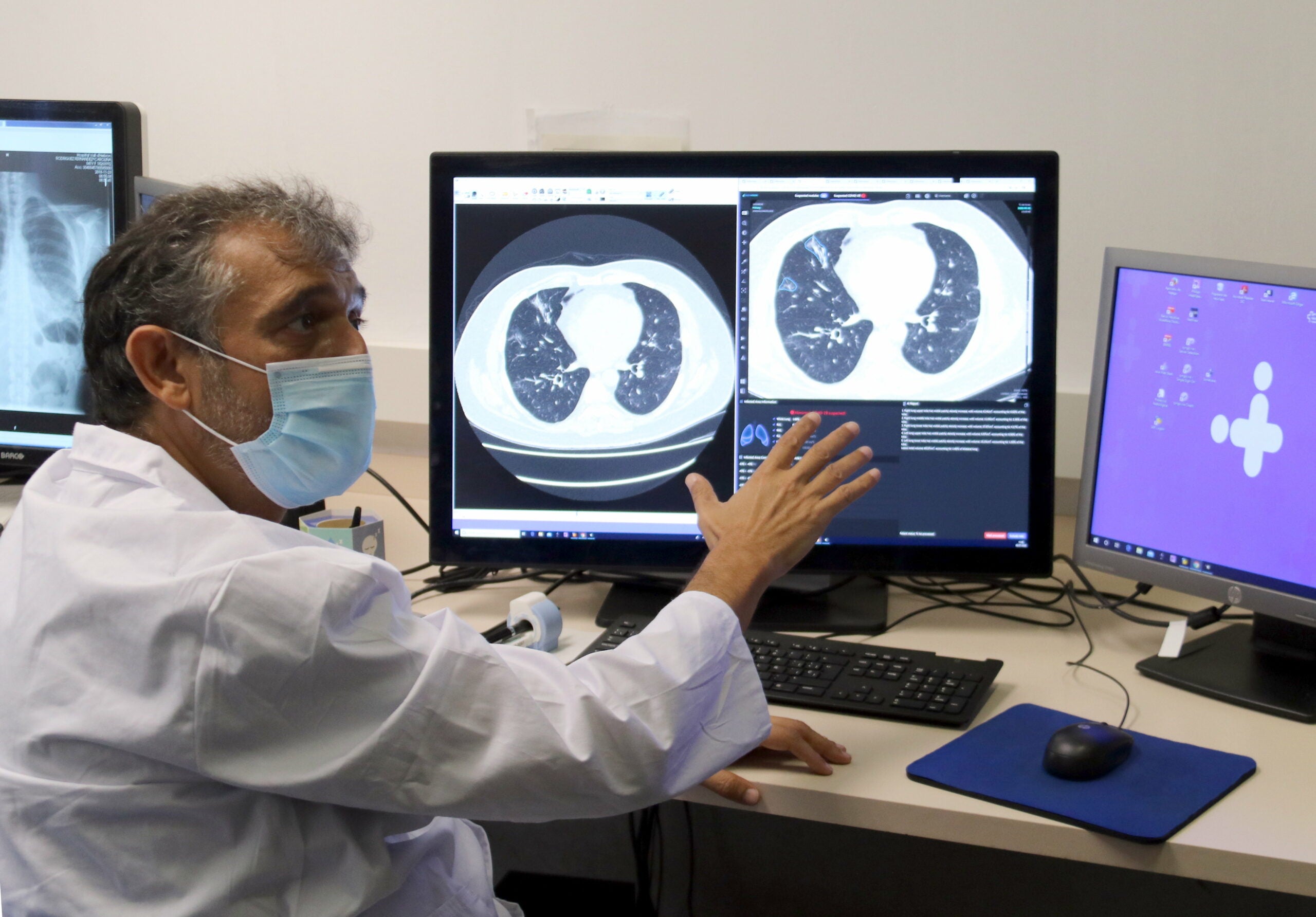 Manel Escobar, director clínic de diagnòstic per la imatge de l'hospital Vall d'Hebron ensenyant la nova eina d'anàlisi de TAC pulmonars per detectar covid-19 / ACN