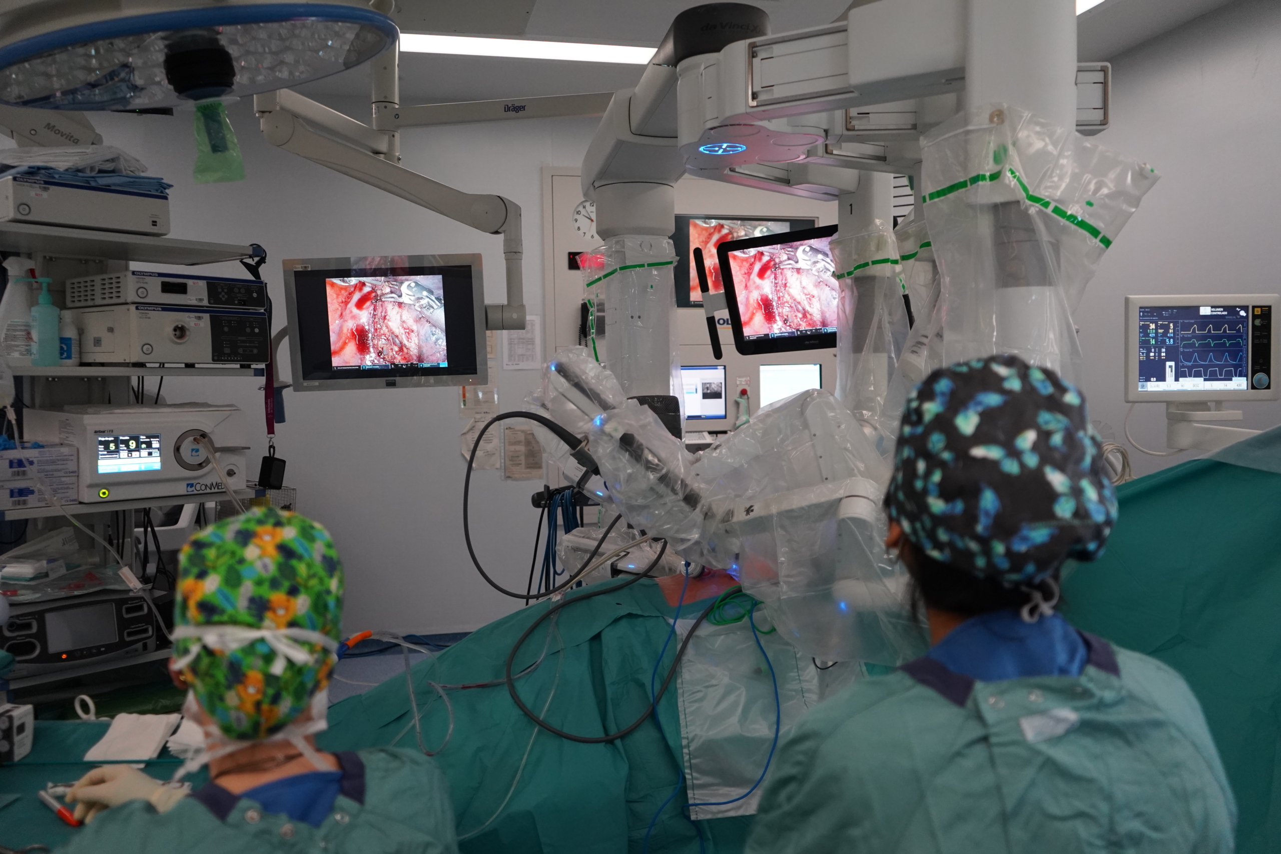 Fins ara només s'havia aconseguit introduir aquesta tècnica de cirurgia per realitzar una part d'aquesta intervenció / Hospital Vall d'Hebron
